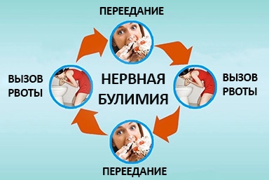 Лечение булимии в Волосово